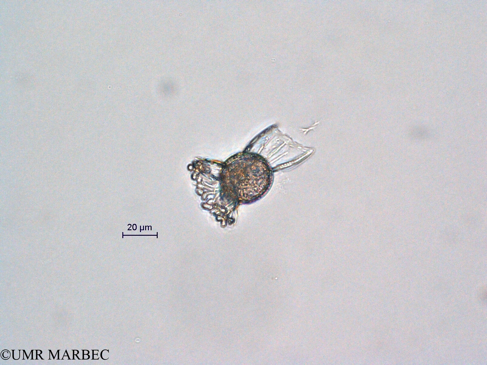 phyto/Scattered_Islands/all/COMMA April 2011/Ornithocercus heteroporus (ancien O. sp3 recomposé-O. magnificus)(copy).jpg